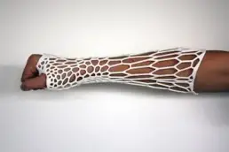 3d Printed Cast