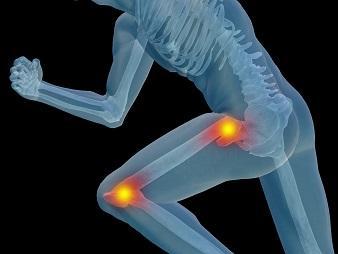 reduce arthritis pain after a knee replacement